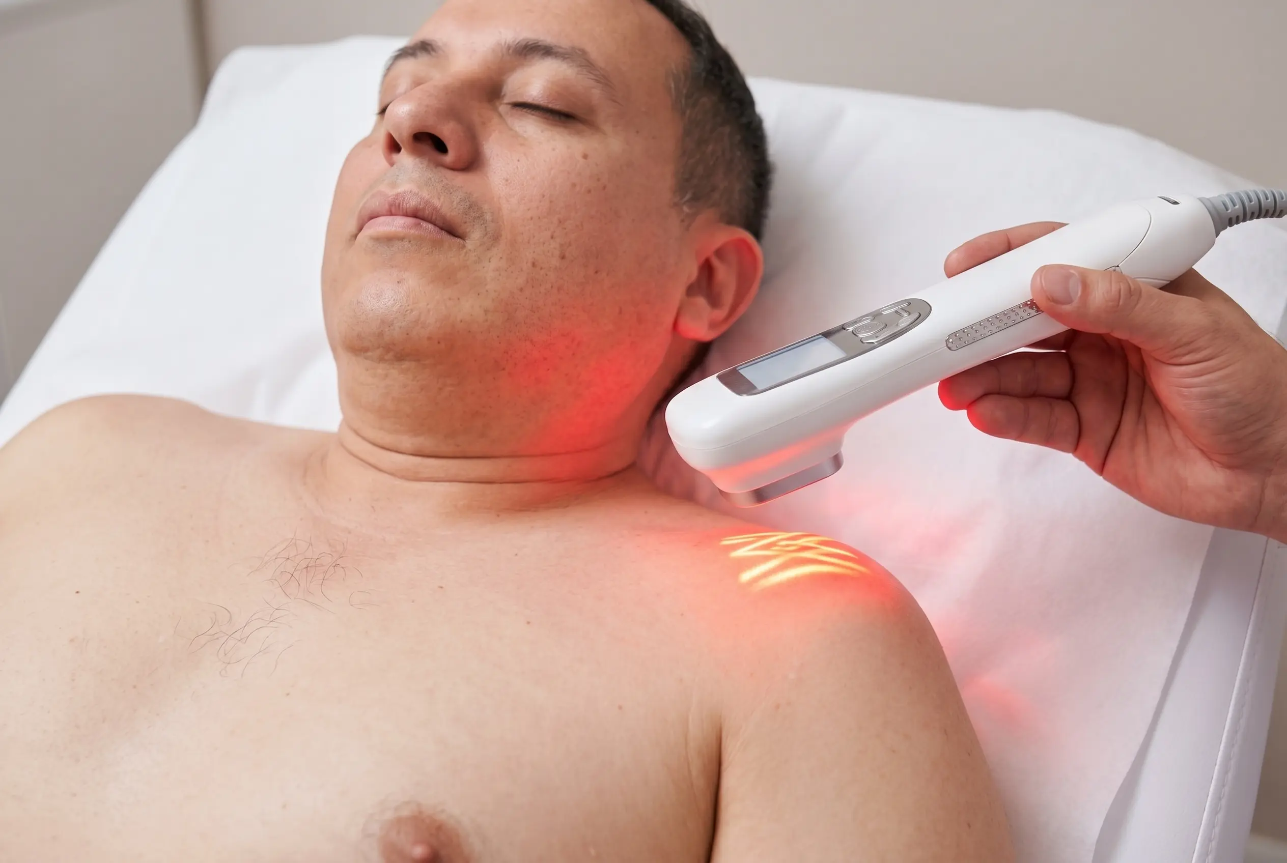 Aplicación de láser terapéutico en hombro para tendinitis y proceso inflamatorio.